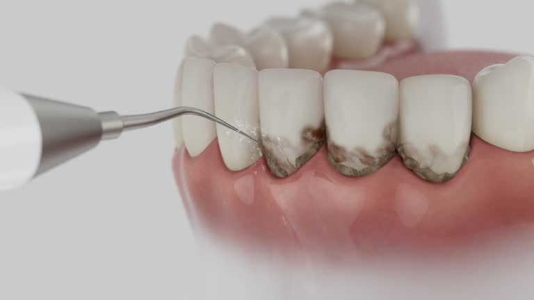 Reliable Dental Implants contractor in Salina, OK by Smile Center Dentistry